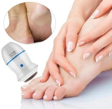 Učitajte sliku u preglednik galerije, Turpija Za Pete Na USB Punjenje™